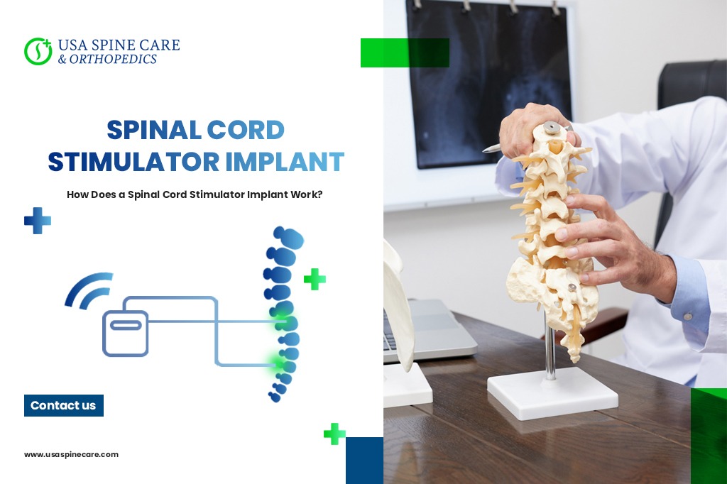 spinal-cord-stimulator-implant