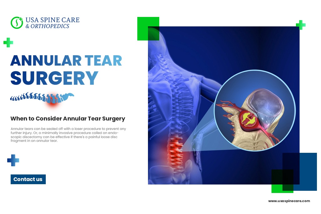 annular tear surgery specialist