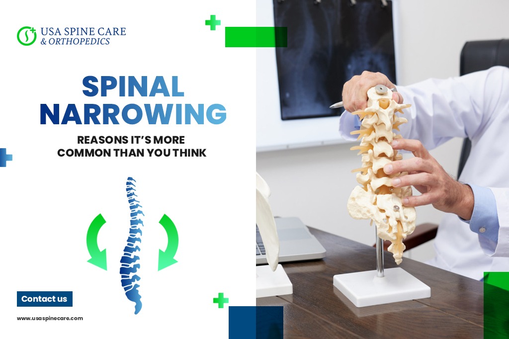 Spinal Narrowing