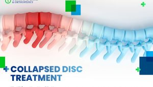 collapsed spinal disc treatment options