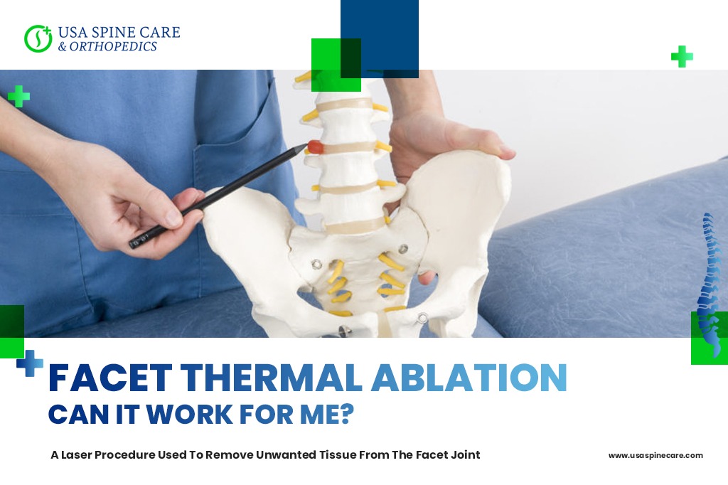 facet thermal ablation quick answers