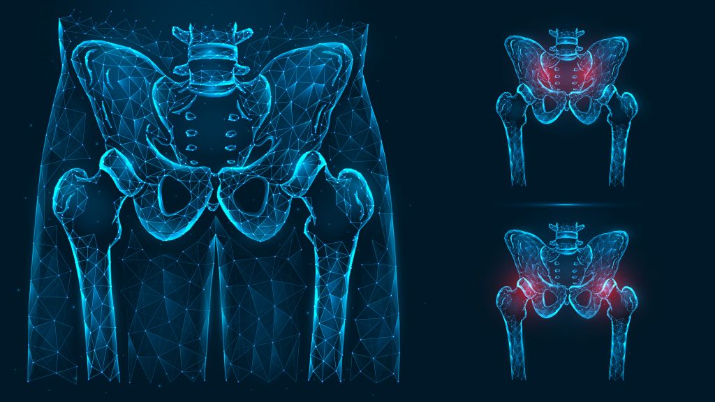 What is Rheumatoid Arthritis of the Hip? USA Spine Care & Orthopedics