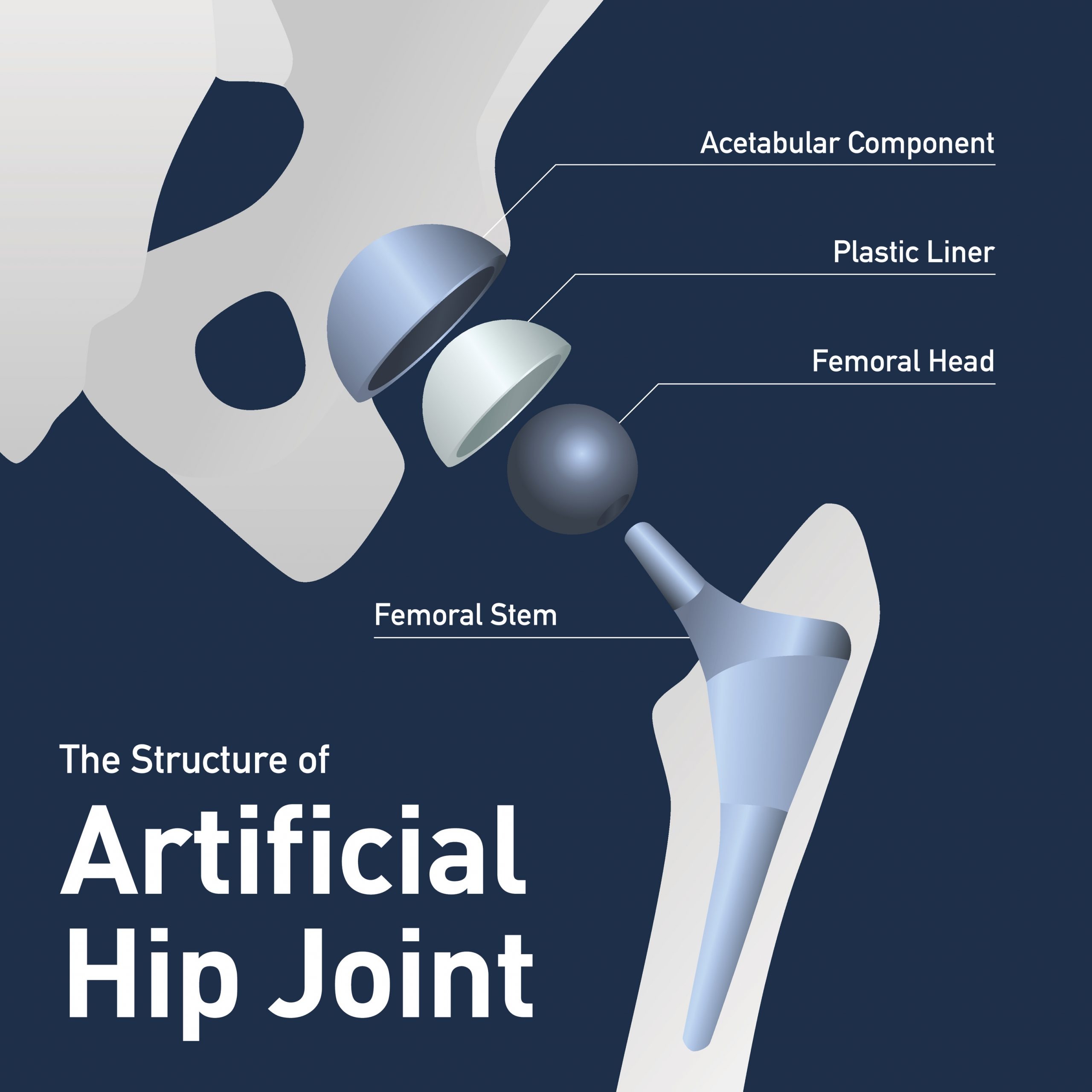 what is the difference between partial and total hip replacement