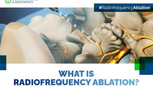 Radiofrequency-ablation