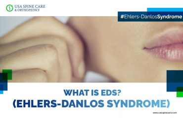 Ehlers-Danlos syndrome