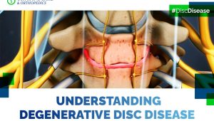 Degenerative-disk-disease