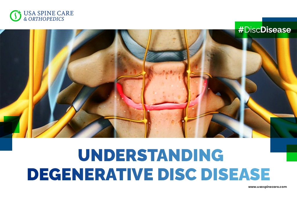 Degenerative-disk-disease